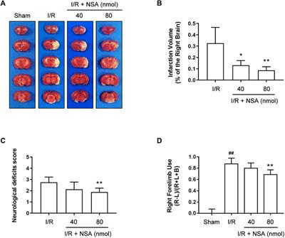 The brain protection of MLKL inhibitor necrosulfonamide against focal ischemia/reperfusion injury associating with blocking the nucleus and nuclear envelope translocation of MLKL and RIP3K